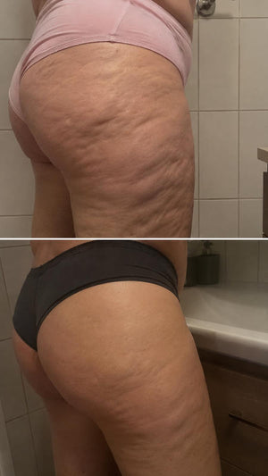 Dermatis ™ — photo envoyée par Élodie B.