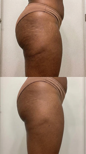Dermatis ™ — photo envoyée par Léa V.